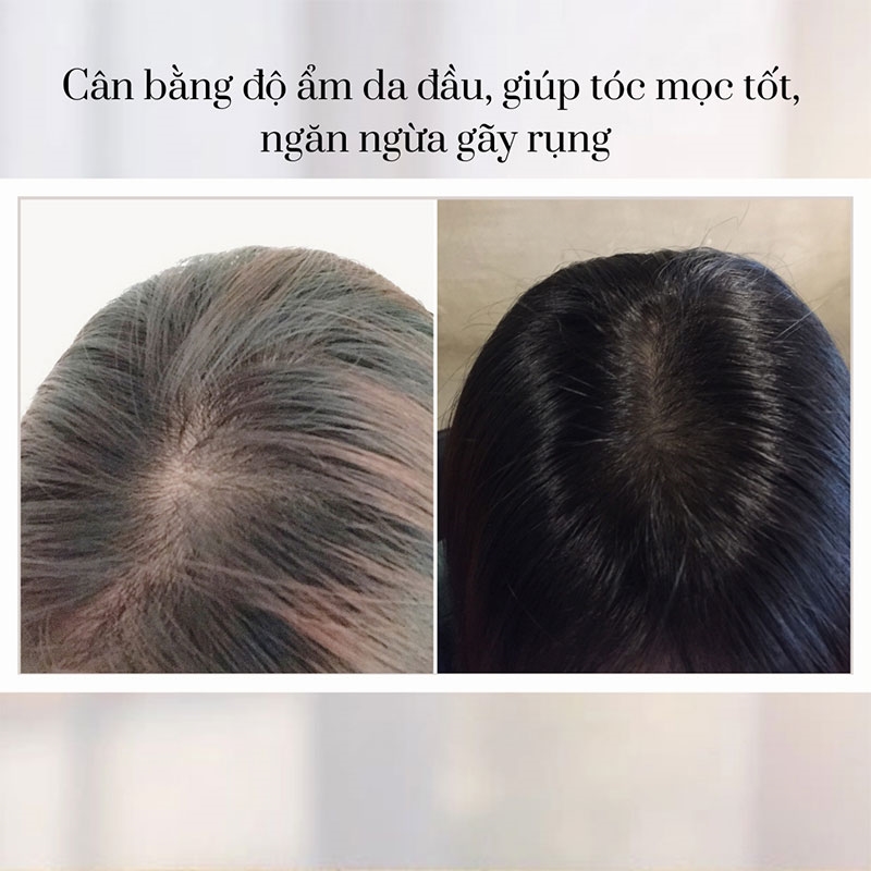 Dầu gội trị gàu ngứa Rishiri 400ml thương hiệu 