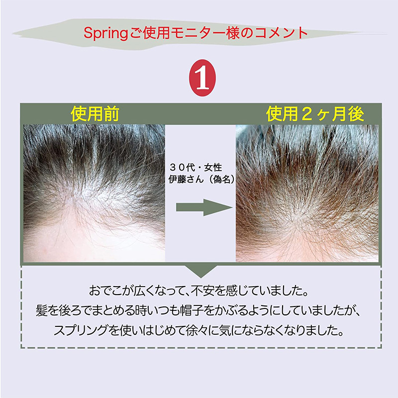 Tinh chất dưỡng tóc giảm gãy rụng, hỗ trợ mọc tóc Nhật Bản Spring 120ml thương hiệu 