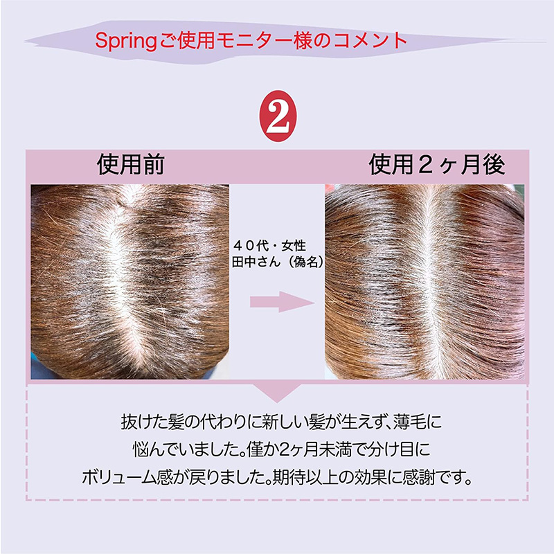 Tinh chất dưỡng tóc giảm gãy rụng, hỗ trợ mọc tóc Nhật Bản Spring 120ml thương hiệu 