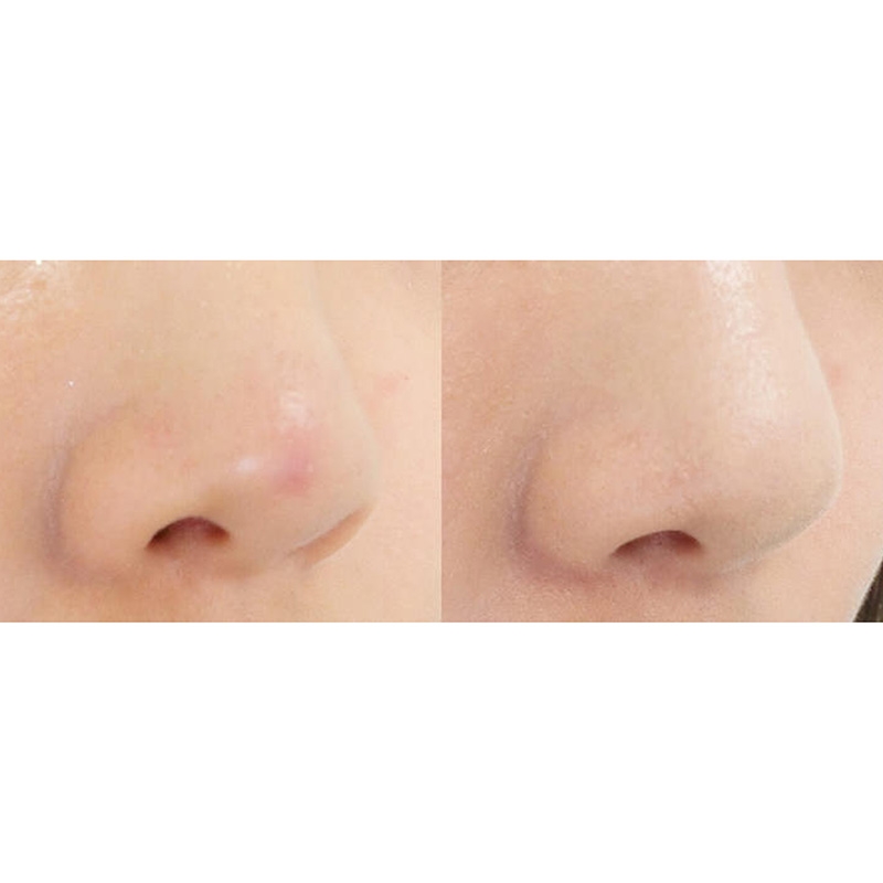 Cây che khuyết điểm Nhật Bản Kate Stick Concealer A Natural Beige 3.1g thương hiệu KANEBO